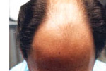 Male Hair example 4 before